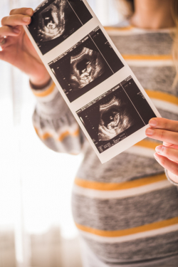 Ultrasound