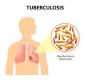 Tuberculosis